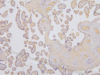 KCC2/SLC12A5 Rabbit Polyclonal Antibody