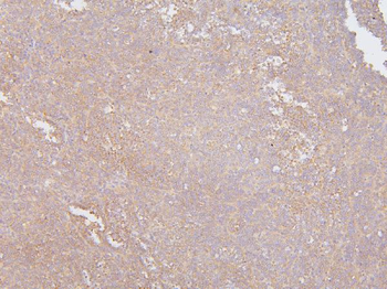 KCC2/SLC12A5 Rabbit Polyclonal Antibody