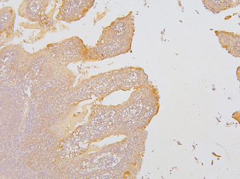 KCC2/SLC12A5 Rabbit Polyclonal Antibody