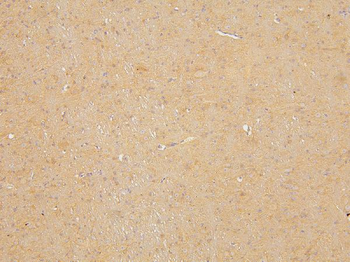 KCC2/SLC12A5 Rabbit Polyclonal Antibody