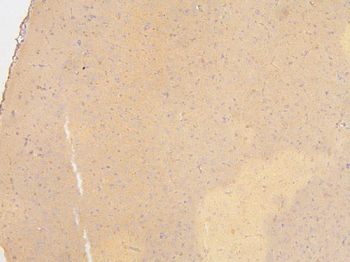KCC2/SLC12A5 Rabbit Polyclonal Antibody