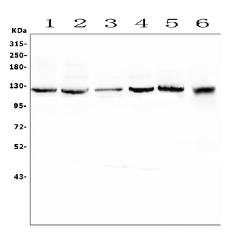 KCC2/SLC12A5 Rabbit Polyclonal Antibody
