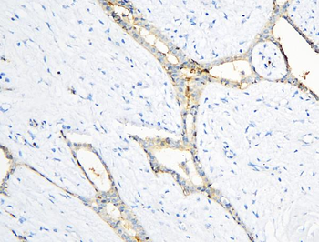 Annexin A3/ANXA3 Antibody