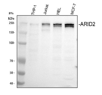 ARID2 Rabbit Polyclonal Antibody