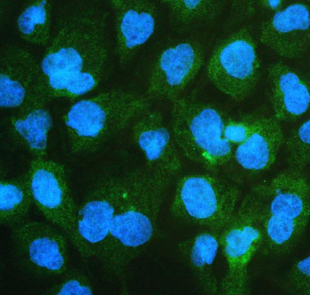 ch TOG/CKAP5 Rabbit Polyclonal Antibody