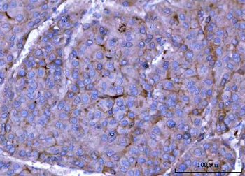 ch TOG/CKAP5 Rabbit Polyclonal Antibody