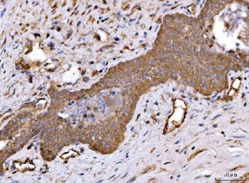 ch TOG/CKAP5 Rabbit Polyclonal Antibody