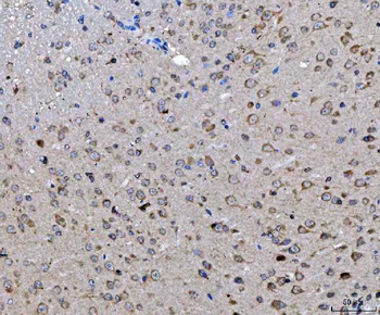 ch TOG/CKAP5 Rabbit Polyclonal Antibody