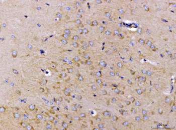 ch TOG/CKAP5 Rabbit Polyclonal Antibody