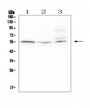 D6/ACKR2 Rabbit Polyclonal Antibody