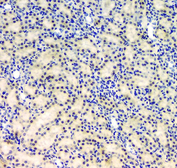 BCL9L Rabbit Polyclonal Antibody