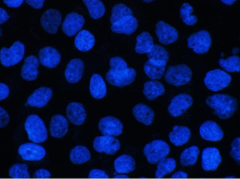 BCL9L Rabbit Polyclonal Antibody