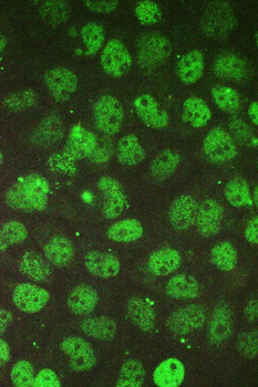 BCL9L Rabbit Polyclonal Antibody