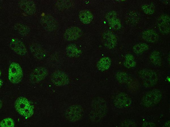 BCL9L Rabbit Polyclonal Antibody