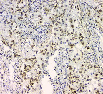 BCL9L Rabbit Polyclonal Antibody