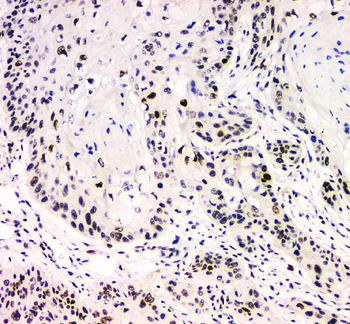 BCL9L Rabbit Polyclonal Antibody