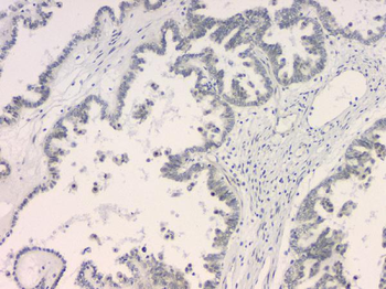 BCL9L Rabbit Polyclonal Antibody