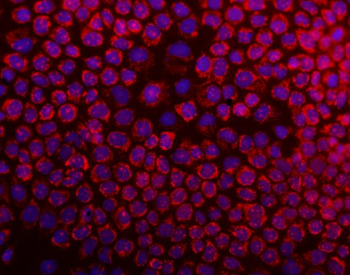 DARS2 Rabbit Polyclonal Antibody