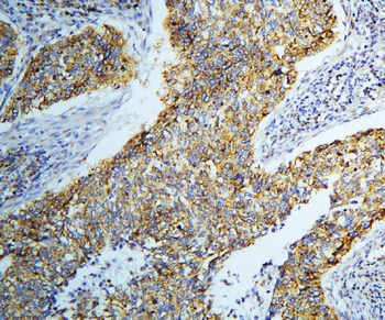 DARS2 Rabbit Polyclonal Antibody