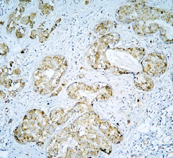 DARS2 Rabbit Polyclonal Antibody
