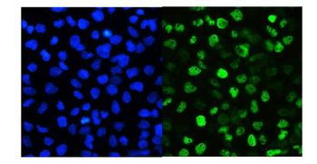 SMARCAD1 Rabbit Polyclonal Antibody