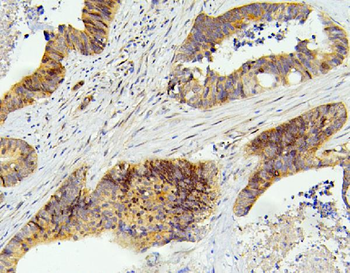 SMARCAD1 Rabbit Polyclonal Antibody