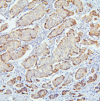 SMARCAD1 Rabbit Polyclonal Antibody