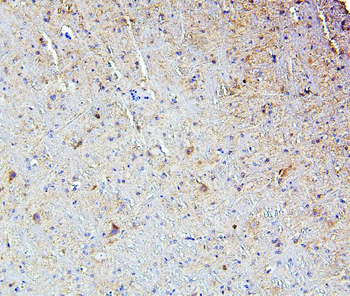 SMARCAD1 Rabbit Polyclonal Antibody