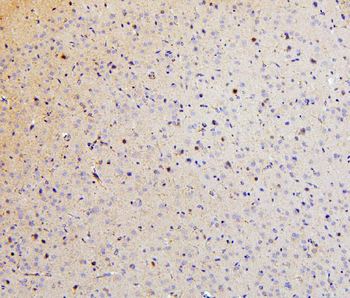 SMARCAD1 Rabbit Polyclonal Antibody