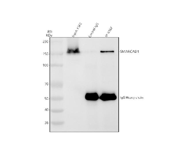 SMARCAD1 Rabbit Polyclonal Antibody
