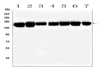 SMARCAD1 Rabbit Polyclonal Antibody