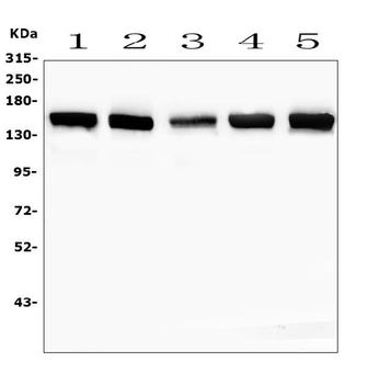 SMARCAD1 Rabbit Polyclonal Antibody