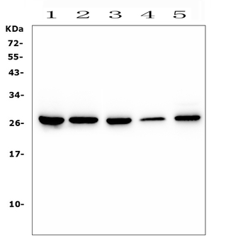 CD160 Rabbit Polyclonal Antibody