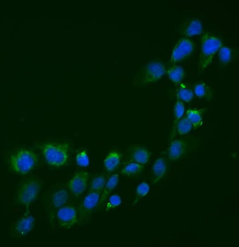 Semaphorin 3B/SEMA3B Rabbit Polyclonal Antibody