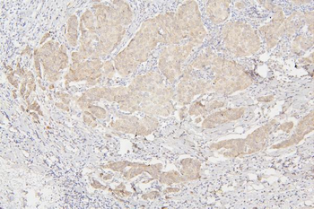 Semaphorin 3B/SEMA3B Rabbit Polyclonal Antibody