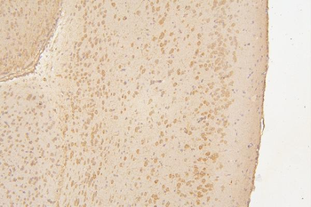 Semaphorin 3B/SEMA3B Rabbit Polyclonal Antibody