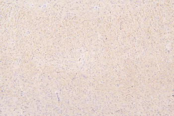 Semaphorin 3B/SEMA3B Rabbit Polyclonal Antibody