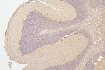 Semaphorin 3B/SEMA3B Rabbit Polyclonal Antibody
