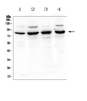 Semaphorin 3B/SEMA3B Rabbit Polyclonal Antibody