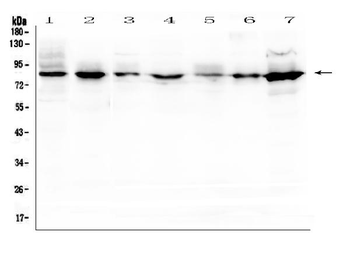 Semaphorin 3B/SEMA3B Rabbit Polyclonal Antibody
