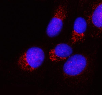 PPA2 Antibody