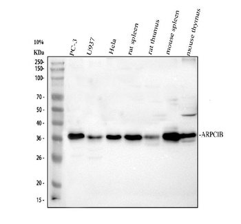 ARP2/3 subunit 1B/ARPC1B Rabbit Polyclonal Antibody