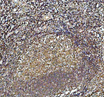 ARP2/3 subunit 1B/ARPC1B Rabbit Polyclonal Antibody