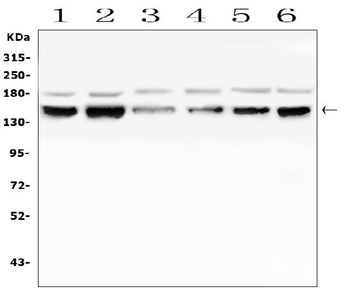 RAB3GAP2 Rabbit Polyclonal Antibody