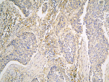 Pyrophosphatase 1/PPA1 Rabbit Polyclonal Antibody