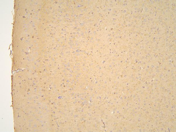 Pyrophosphatase 1/PPA1 Rabbit Polyclonal Antibody