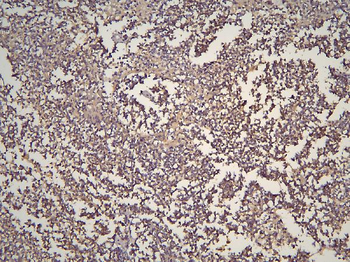 HOOK3 Rabbit Polyclonal Antibody