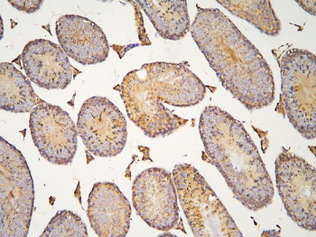 HOOK3 Rabbit Polyclonal Antibody