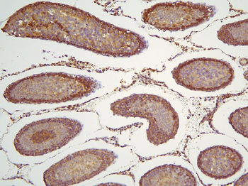 HOOK3 Rabbit Polyclonal Antibody
