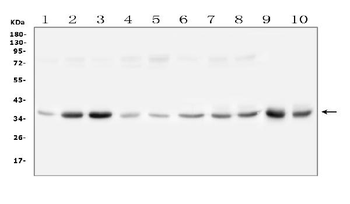 GPD1L Rabbit Polyclonal Antibody